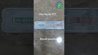 HCV positive test | Ict anti-HCV antibody | hcv test | hepatitis C test