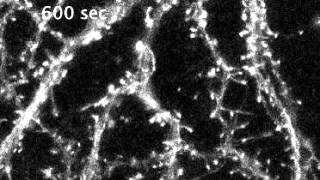 F-actin accumulation in dendritic spines