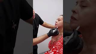 Chin Filler Session: Kickstarting an Incredible Transformation Journey! 💫