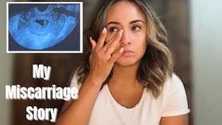 MY MISCARRIAGE STORY | 10 WEEKS | LIVE ULTRASOUND