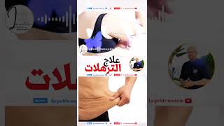 علاج الترهلات بوصفات طبيعية وصفات الدكتور عماد ميزاب wasafat Docteur Imad  #اكسبلور #dr_imad_mizab