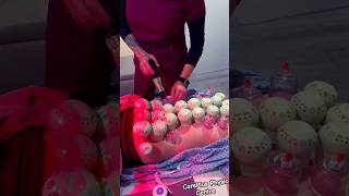 Updated HIJAMA 🪬 #satisfying #chiropractor #chiropractic #hijama #therapy #viral #trending #youtube