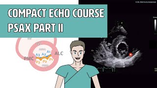 〖Echocardiography〗 Parasternal short axis - Anatomy part II (PSAX)