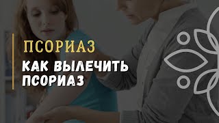 Псориаз. Как вылечить псориаз