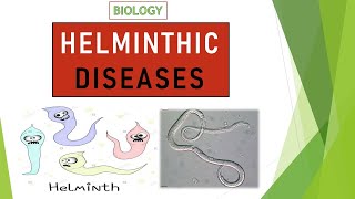 HELMINTHIC DISEASES| HELMINTHIASIS | BIOLOGY TUTORIALS