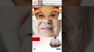 وصفة للتجاعيد والبشرة الجافة الدكتور عماد ميزاب Docteur Imad Mizab #short #shortvideo #shortsvideo