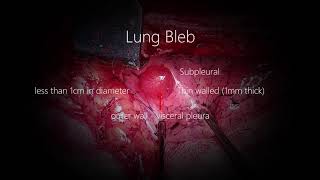 Lung Blebs/ Bullae