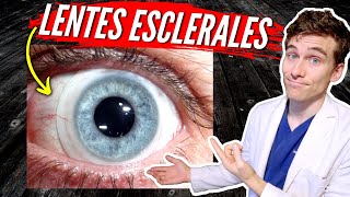 Lentes Esclerales Para Queratocono: 7 Datos Que Debe Saber