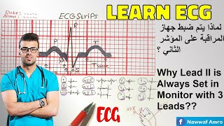 لماذا يتم ضبط جهاز المراقبة على المؤشر الثاني ؟ Why Lead II is always set in monitor with 3 leads??