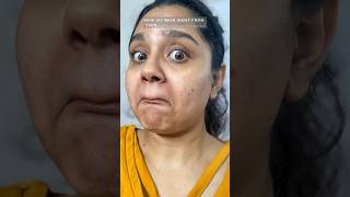 😱 My കൊമ്പന്‍  SKIN CHANGE 😩 #shorts #ShopWithYouTube