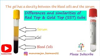 Red top vacutainer & Serum separator (Gold top) tube। Differences and similarities। #barman_sir