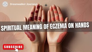 Eczema on Hands? The Hidden Spiritual Message You Need to Know