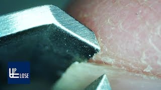 Gross!!! Up Close Fingernail Clipping with a Microscope