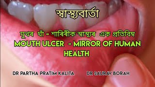 মুখৰ  ঘাঁ - শাৰিৰীক স্বাস্থ্যৰ  এক প্ৰতিবিম্ব l MOUTH ULCER-MIRROR OF HUMAN HEALTH lস্বাস্থ্যবাৰ্তা