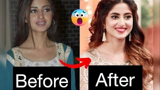 Pakistani Actresses and actors then and now 💖😲|| Then & Now || Shocking transformation 😱||#bollywood