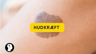 HUDKRÆFT: SÅDAN SPOTTER DU DET!