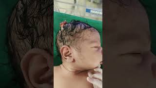 abnormal skin development on head #comment and subcribe