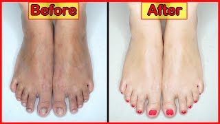 * WINTER CARE * FEET WHITENING SPA PEDICURE AT HOME (with Eng. Subs)