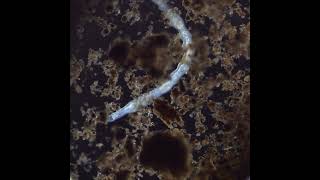 Some type of microscopic worm, maybe 1-2mm long