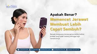 Hindari memencet jerawat untuk menghindari risiko infeksi dan bekas luka yang membandel! 🚫