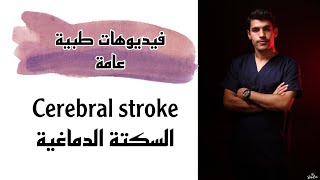 cerebral stroke       السكتة الدماغية