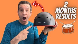 iRestore Elite Laser Hair Growth System 2 Month Update