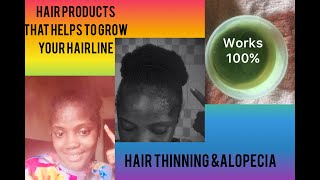 Products that helps to grow your hairline,hair thinning &Alopecia.