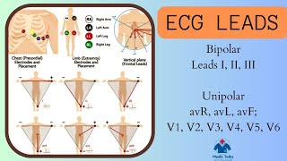 ECG LEADS | Explained | Leads I, II, III | Leads avR, avL, avF, V1, V2, V3, V4, V5, V6 | Dr Krunal