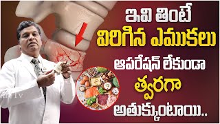 విరిగిన ఎముకలు త్వరగా అతుక్కోవాలంటే? | Bone Fracture Healing Foods | Health Tips | Dhatri TV