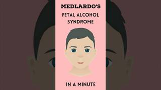 Fetal alcohol syndrome in a minute #medicine #doctor #medschool #medstudent #nurse #medicalstudent