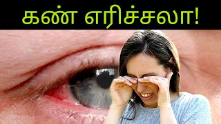 கண் எரிச்சல் குணமாக| How to reduce eye burning in tamil| kan erichal neenga| shorts