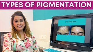 Type Of Pigmentation | Hyperpigmentation | Cutis Skin Solution