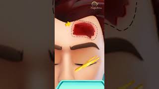 Asmr head surgery treatment #youtubeshort #shortvideo