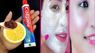 Apply Colgate toothpaste on Your Skin and See the Magic |❤️ Lemon and colgate ❤️