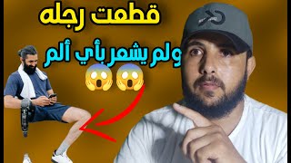 من يكن التابعي الذي قطعت قدمه ولم يشعر بالألم #تاريخ #قصص