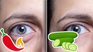 6 Foods That Can Give You Puffy Eyes and 4 That Can Fix Them