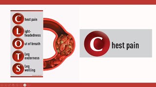 Chest Pain - The first letter in CLOTS