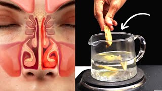 3 Ways to Cure Allergic Rhinitis Permanently Naturally At Home