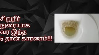 🆕🔴சிறுநீர் நுரையாக வர இந்த 5 தான் காரணம்!!When does a Diabetic patient pass Frothy Urine?#Diabetes