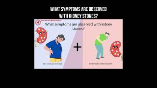 What symptoms are observed with kidney stones? #kidneystones #kidneystone #kidney #nephrology