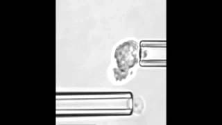 13 5 Phagocytosis Neutrophil