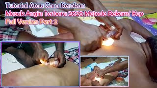 🔴🔵 Tutorial Atau Cara Kerokan Masuk Angin Terbaru 2020 Metode Bekam/ Kop Full Version Part 2