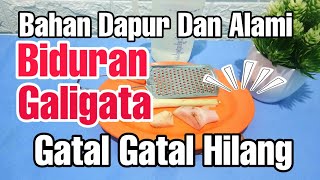 Rebusan jahe + Serai + Lengkuas Dapat Mengobati Biduran Galigata