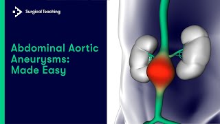 Aortic Aneurysms | All you need to know for med school