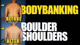 Body Banking Procedure 1 Year Later Male Plastic Surgery