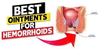 Best Ointments for Hemorrhoids