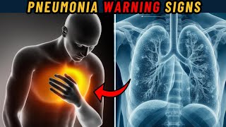 Don't Ignore These Symptoms of Pneumonia | Pneumonia Symptoms | Pneumonia Signs