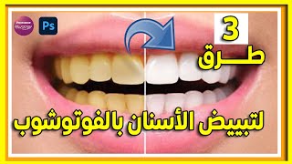 كيف تبيض أسنانك بالفوتوشوب بدون جهد؟