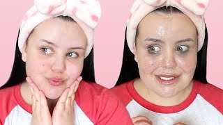 MY UPDATED SKINCARE ROUTINE | Clear Skin After Severe Acne (Night)