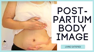 Body Image: Stretch Marks and Postpartum